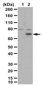 Anti-Menin/MEN1 Antibody serum, from rabbit