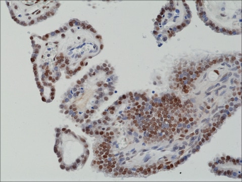 Anti-c-Fos antibody, Rabbit monoclonal recombinant, expressed in HEK 293 cells, clone RM374, purified immunoglobulin