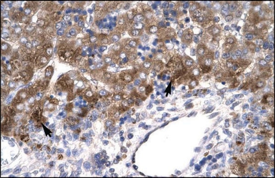 Anti-MEOX1 antibody produced in rabbit affinity isolated antibody