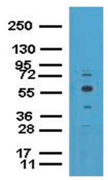 ChIPAb+ EED - ChIP Validated Antibody and Primer Set from rabbit