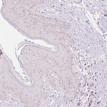 Anti-NVL antibody produced in rabbit Prestige Antibodies&#174; Powered by Atlas Antibodies, affinity isolated antibody, buffered aqueous glycerol solution