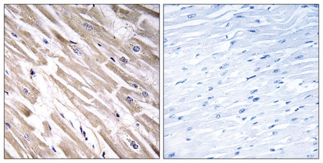 Anti-FGF18 antibody produced in rabbit affinity isolated antibody