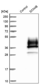 Anti-SCN4B antibody produced in rabbit Prestige Antibodies&#174; Powered by Atlas Antibodies, affinity isolated antibody, buffered aqueous glycerol solution