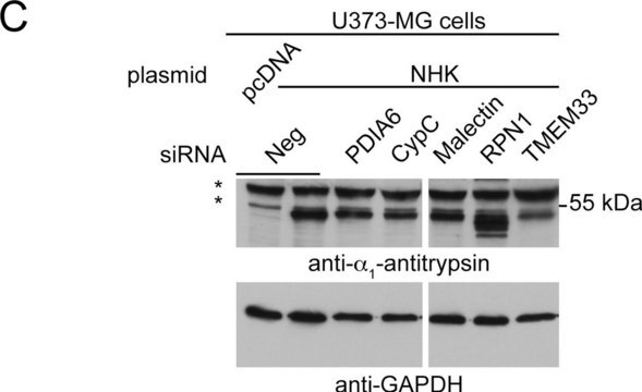 Anti-&#945;1-Antitrypsin antibody produced in rabbit IgG fraction of antiserum