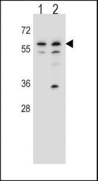 ANTI-MOUSE PINK (CENTER) antibody produced in rabbit IgG fraction of antiserum, buffered aqueous solution