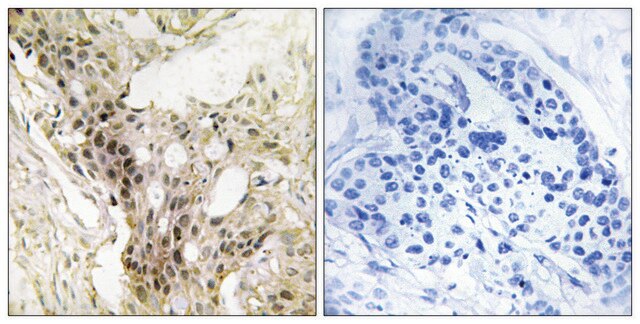 Anti-MED21 antibody produced in rabbit affinity isolated antibody