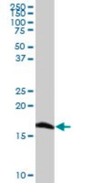 Anti-SOD1 antibody produced in mouse purified immunoglobulin, buffered aqueous solution