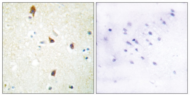 Anti-5-HT-2B antibody produced in rabbit affinity isolated antibody