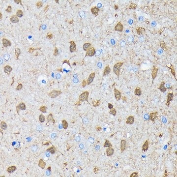 Anti-PGP9.5/UCHL1 antibody produced in rabbit