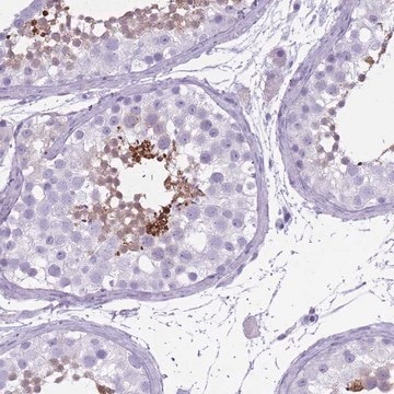 Anti-OR7C1 antibody produced in rabbit Prestige Antibodies&#174; Powered by Atlas Antibodies, affinity isolated antibody, buffered aqueous glycerol solution