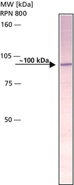 Anti-Amyloid Precursor Protein, N-Terminal antibody produced in rabbit IgG fraction of antiserum, buffered aqueous solution