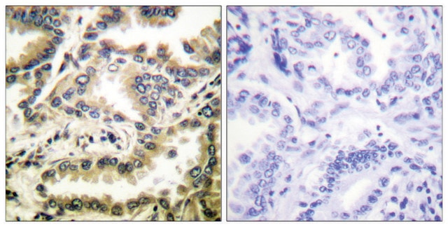 Anti-NF-&#954;B p65 (Acetyl-Lys310) antibody produced in rabbit affinity isolated antibody