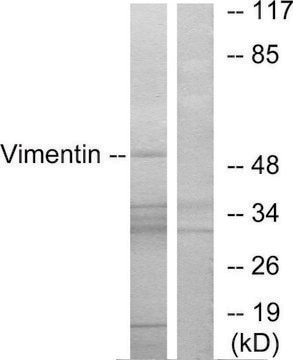 Anti-Vimentin antibody produced in rabbit affinity isolated antibody