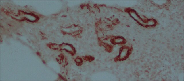 Anti-Mouse IgG (whole molecule)–Peroxidase antibody produced in rabbit IgG fraction of antiserum, buffered aqueous solution