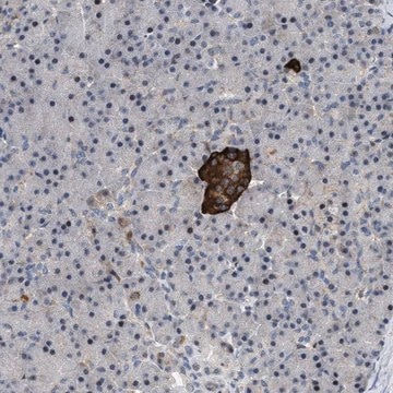 Anti-ZDHHC15 antibody produced in rabbit Prestige Antibodies&#174; Powered by Atlas Antibodies, affinity isolated antibody, buffered aqueous glycerol solution