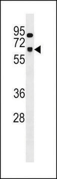 ANTI-SNRNP70 (CENTER) antibody produced in rabbit affinity isolated antibody, buffered aqueous solution