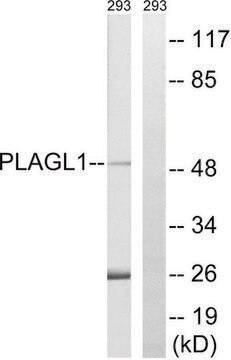 Anti-PLAGL1 antibody produced in rabbit affinity isolated antibody