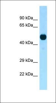 Anti-CDK14 antibody produced in rabbit affinity isolated antibody