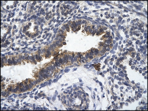 Anti-ZFR antibody produced in rabbit affinity isolated antibody