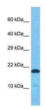 Anti-EIF5A (C-terminal) antibody produced in rabbit affinity isolated antibody