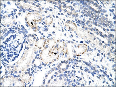 Anti-MyC antibody produced in rabbit IgG fraction of antiserum