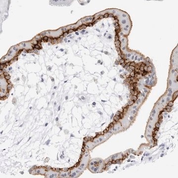 Anti-SLC19A1 antibody produced in rabbit Prestige Antibodies&#174; Powered by Atlas Antibodies, affinity isolated antibody, buffered aqueous glycerol solution