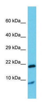 Anti-Grem1 antibody produced in rabbit affinity isolated antibody