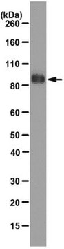 Anti-COMP (Thrombospondin-5) Antibody, clone 484D1 clone 484D1, from rat