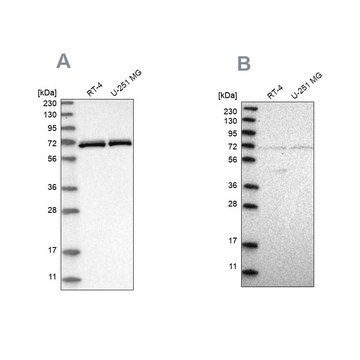 Anti-NPLOC4 antibody produced in rabbit Prestige Antibodies&#174; Powered by Atlas Antibodies, affinity isolated antibody, buffered aqueous glycerol solution, Ab1