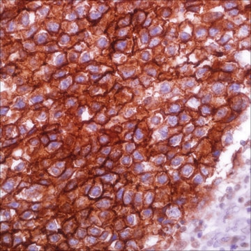 Podoplanin (D2-40) Mouse Monoclonal Antibody