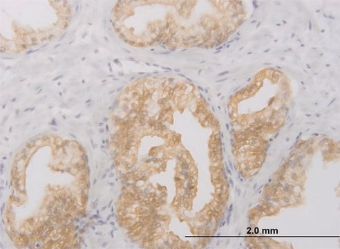 Monoclonal Anti-RIPK2, (C-terminal) antibody produced in mouse clone 6F7, purified immunoglobulin, buffered aqueous solution