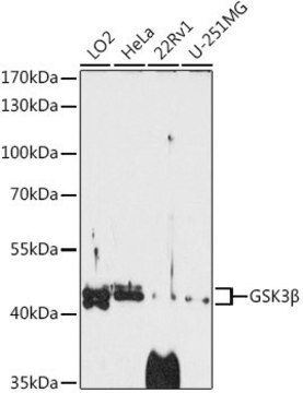 Anti- GSK3&#946; antibody produced in rabbit