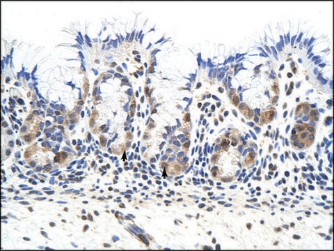 Anti-PRKRA antibody produced in rabbit affinity isolated antibody