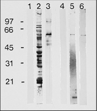 Anti-Human IgG (&#947;-chain specific)&#8722;Peroxidase antibody produced in goat affinity isolated antibody, buffered aqueous solution