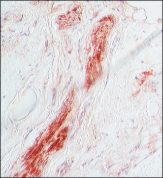 Anti-S-100 antibody produced in rabbit IgG fraction of antiserum, buffered aqueous solution