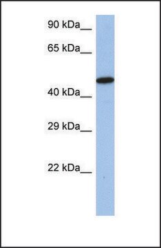 Anti-IRF5 antibody produced in rabbit affinity isolated antibody