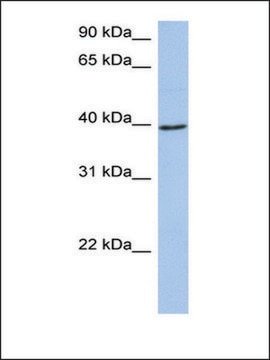 Anti-ACADM antibody produced in rabbit affinity isolated antibody