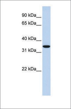 Anti-MARCH1 antibody produced in rabbit affinity isolated antibody