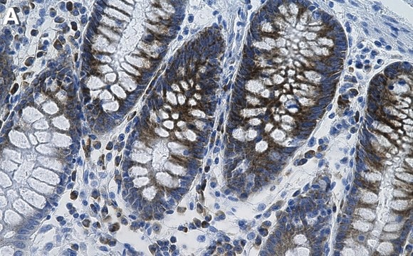 Anti-CD138/Syndecan-1 Antibody, clone 3N22-1 ZooMAb&#174; Rabbit Monoclonal recombinant, expressed in HEK 293 cells