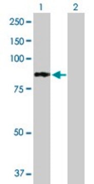 Anti-PFKL antibody produced in mouse purified immunoglobulin, buffered aqueous solution