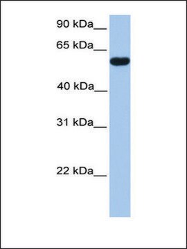 Anti-CUGBP2 antibody produced in rabbit affinity isolated antibody