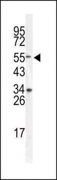 ANTI-DONSON (CENTER) antibody produced in rabbit IgG fraction of antiserum, buffered aqueous solution