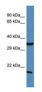 Anti-TIMP1 (N-terminal) antibody produced in rabbit affinity isolated antibody