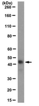 Anti-MyoD Antibody, clone 5F11 clone 5F11, from rat