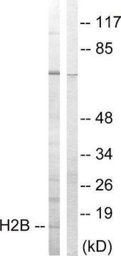 Anti-Histone H2B antibody produced in rabbit affinity isolated antibody