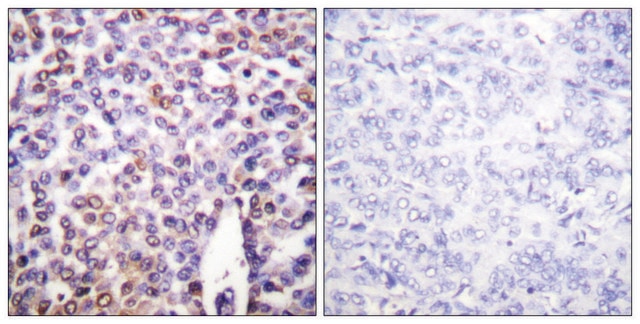 Anti-Histone H4 antibody produced in rabbit affinity isolated antibody