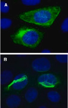 LentiBrite GFP-Vimentin Lentiviral Biosensor