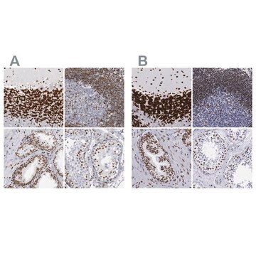 Anti-MECP2 antibody produced in rabbit Ab2, Prestige Antibodies&#174; Powered by Atlas Antibodies, affinity isolated antibody, buffered aqueous glycerol solution