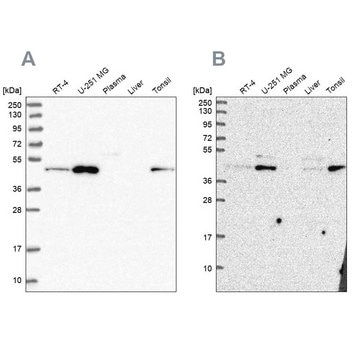 Anti-ZDHHC16 antibody produced in rabbit Prestige Antibodies&#174; Powered by Atlas Antibodies, affinity isolated antibody, buffered aqueous glycerol solution