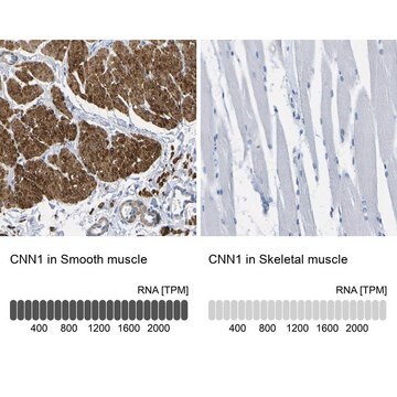 Anti-CNN1 antibody produced in rabbit Prestige Antibodies&#174; Powered by Atlas Antibodies, affinity isolated antibody, buffered aqueous glycerol solution